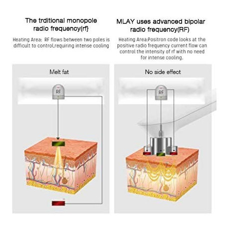 MLAY Appareil RF Anti-Âge: Lifting Visage, Réduction des Rides, Rajeunissement à Domicile