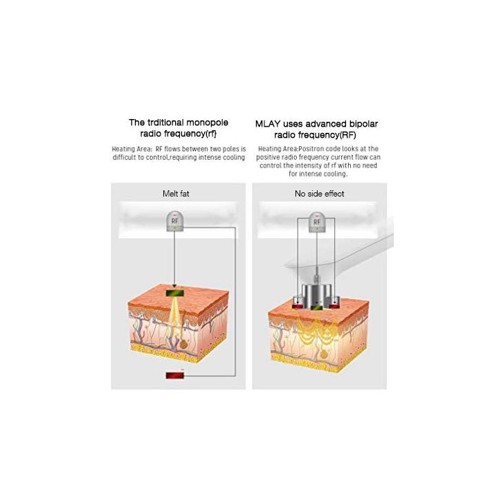 MLAY Appareil RF Anti-Âge: Lifting Visage, Réduction des Rides, Rajeunissement à Domicile MLAY Appareil RF Anti-Âge: Lifting Visage, Réduction des Rides, Rajeunissement à Domicile