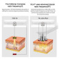 MLAY Appareil RF Anti-Âge: Lifting Visage, Réduction des Rides, Rajeunissement à Domicile MLAY Appareil RF Anti-Âge: Lifting Visage, Réduction des Rides, Rajeunissement à Domicile