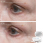 Trophy Skin UltradermMD: At-Home Microdermabrasion for Radiant, Youthful Skin