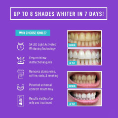 iSmile, le blanchiment des dents par lumière LED