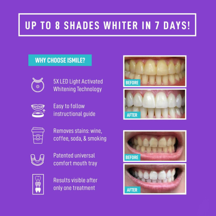 iSmile Advanced Teeth Whitening Kit: Get a Brighter Smile Fast with LED Light! iSmile Advanced Teeth Whitening Kit: Get a Brighter Smile Fast with LED Light!