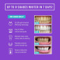 iSmile Advanced Teeth Whitening Kit: Get a Brighter Smile Fast with LED Light! iSmile Advanced Teeth Whitening Kit: Get a Brighter Smile Fast with LED Light!
