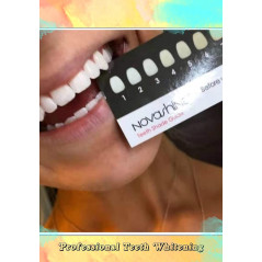 Novashine : Kit de Blanchiment Dentaire LED - Sourire Éclatant Garanti en 15 Minutes!