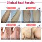 Imene T4 IPL Hair Removal Device: Permanent, Painless Hair Removal at Home Imene T4 IPL Hair Removal Device: Permanent, Painless Hair Removal at Home