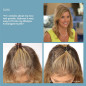 HairMax Laser Comb: FDA-Cleared Hair Growth Treatment - Regrow Thicker, Fuller Hair! HairMax Laser Comb: FDA-Cleared Hair Growth Treatment - Regrow Thicker, Fuller Hair!