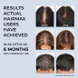 HairMax RegrowMD Laser Cap: FDA-Cleared Hair Growth Treatment - See Results in Months! HairMax RegrowMD Laser Cap: FDA-Cleared Hair Growth Treatment - See Results in Months!