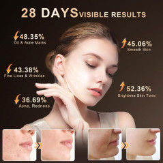 Lovsheme LED Face Mask: Red Light Therapy for Radiant, Healthy Skin | Acne & Wrinkle Treatment