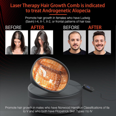 Laser Hair Growth Cap: FDA Cleared Red Light Therapy for Alopecia & Regrowth