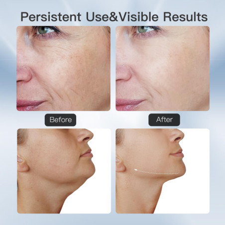 3-in-1 LED Face & Neck Massager: Thermal Vibration for Firming & Anti-Wrinkle Skin Care