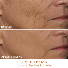 Dr. Dennis Gross DRx SpectraLite FaceWare Pro: LED Mask for Anti-Aging