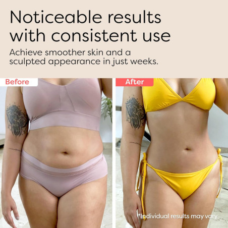3-in-1 Body Sculptor: Anti-Cellulite Massager for Stomach & More