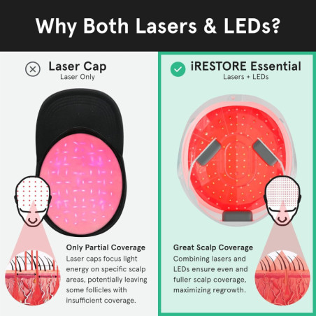 iRestore Essential Laser Hair Growth Cap: FDA Cleared. Regrow Thicker, Fuller Hair at Home!