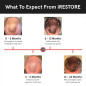 iRestore Essential Laser Hair Growth Cap: FDA Cleared. Regrow Thicker, Fuller Hair at Home! iRestore Essential Laser Hair Growth Cap: FDA Cleared. Regrow Thicker, Fuller Hair at Home!