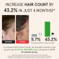 iRestore Essential Laser Hair Growth Cap: FDA Cleared. Regrow Thicker, Fuller Hair at Home! iRestore Essential Laser Hair Growth Cap: FDA Cleared. Regrow Thicker, Fuller Hair at Home!