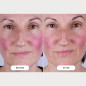 Masque LED CurrentBody Skin Series 2: Rajeunissement Avancé, Peau Visiblement Plus Jeune