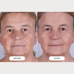 Masque LED CurrentBody Skin Thérapie Série 2 – Efficacité Pro