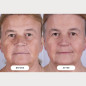 Masque LED CurrentBody Skin Series 2: Rajeunissement Avancé, Peau Visiblement Plus Jeune