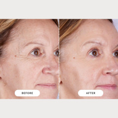 CurrentBody Skin LED Light Therapy Mask Series 2 – Advanced Skincare Tech