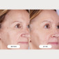 Masque LED CurrentBody Skin Series 2: Rajeunissement Avancé, Peau Visiblement Plus Jeune