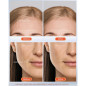 NEWKEY LED Face Mask: Red & Blue Light Therapy for Wrinkle & Acne Reduction - 150 LEDs, 10-Min Shut-Off NEWKEY LED Face Mask: Red & Blue Light Therapy for Wrinkle & Acne Reduction - 150 LEDs, 10-Min Shut-Off