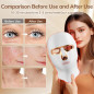 Cordless Red Light Therapy Face Mask, USB-C Rechargeable Infrared LED Mask for Home, Travel & Sleep Cordless Red Light Therapy Face Mask, USB-C Rechargeable Infrared LED Mask for Home, Travel & Sleep