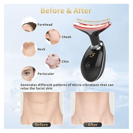 Appareil de Beauté Visage Multifonction avec Vibration et LED 7 Couleurs pour Soins à Domicile