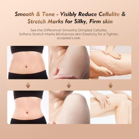 Appareil de Massage Drainage Lymphatique 35 Vitesses 3-en-1 Anti-Cellulite avec Microcourant, Chaleur, Vibration (Blanc)