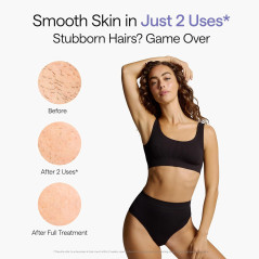 Ulike Air 10 IPL Laser Hair Removal Device – Fast, Painless & Permanent