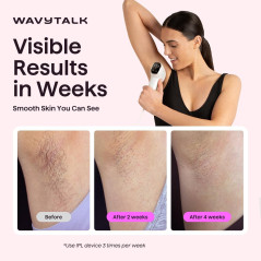 Wavytalk IPL Hair Removal Device for Face & Body – Painless, Long-Lasting, 24J Dual-Pulse & Ice Cooling