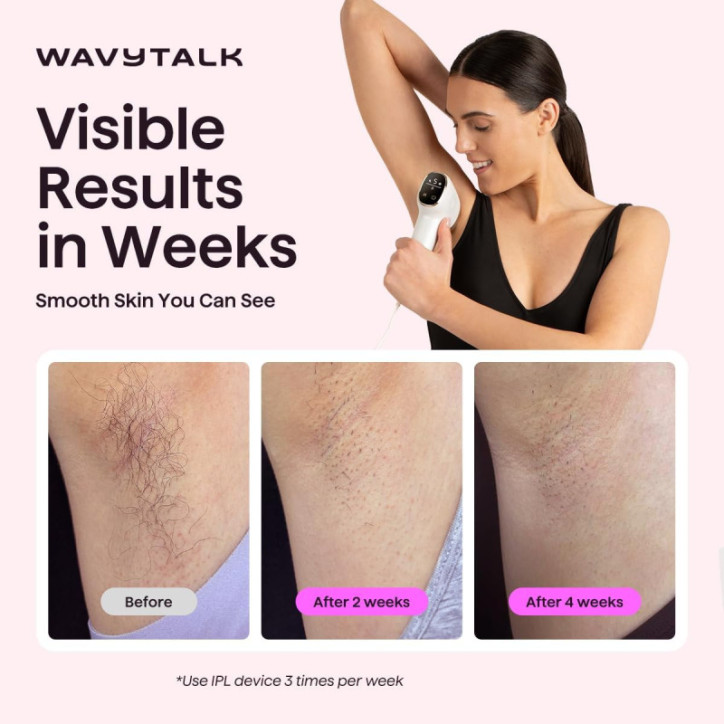 Wavytalk IPL Hair Removal Device for Face & Body – Painless, Long-Lasting, 24J Dual-Pulse & Ice Cooling Wavytalk IPL Hair Removal Device for Face & Body – Painless, Long-Lasting, 24J Dual-Pulse & Ice Cooling