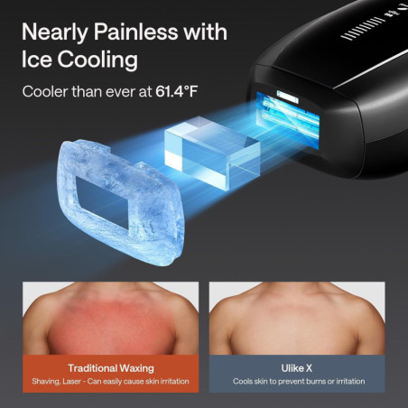 Ulike X IPL Hair Removal Device with Ice-Cooling, Dual Lights & Skin Sensor for Painless, Long-Lasting Smooth Skin