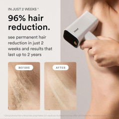 Nood™ NEW Flasher Pro IPL Laser Hair Removal & Anti-Aging Red Light Therapy Device – Pain-Free, Visible Results