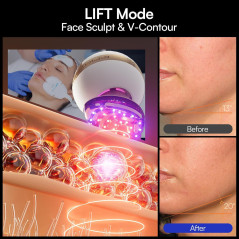 INIA SPHERA 8-en-1 : Appareil Facial Microcourant & Lumière Rouge