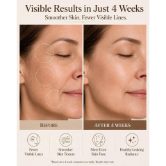 Masque LED Sans Fil pour Visage, 4 Modes Lumière (NIR 850nm, Rouge 620nm, Bleu, Ambre), 272 LEDs, Rechargeable, 10 Min, Peau Écl