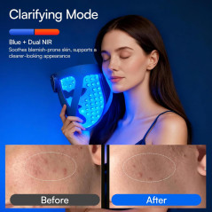 INIA Glow 4D Wireless Red Light Therapy Mask – 320 LEDs, Cordless & Rechargeable