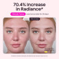 wavytalk Red Light Therapy Face Mask with LED for Anti-Aging, Acne & Skin Rejuvenation - White
