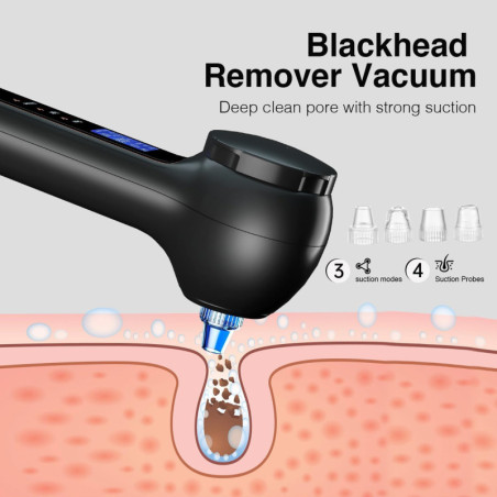 Umickoo Rechargeable Rotating Face Scrubber with Blackhead Remover