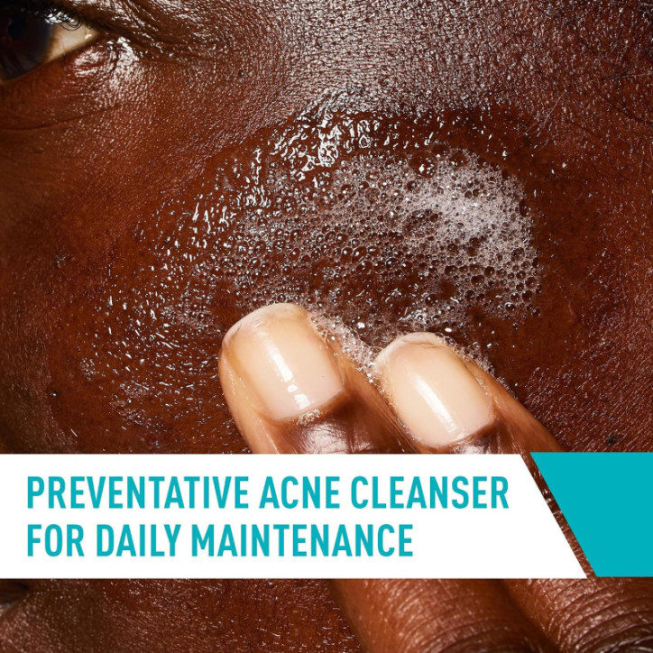 CeraVe Acne Control Nettoyant Visage 2% Acide Salicylique, 16 oz CeraVe Acne Control Nettoyant Visage 2% Acide Salicylique, 16 oz