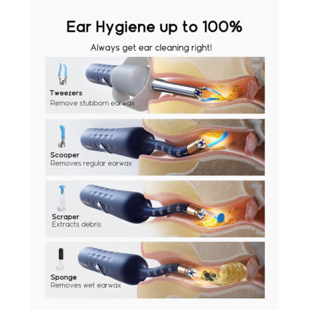 Bebird D39R Ear Wax Removal Kit with HD Camera, Storage Case, and Painless Tweezers