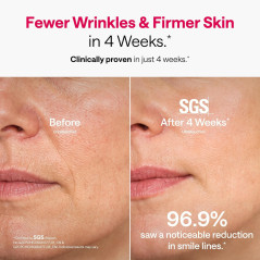 Masque Ulike Lumière Rouge Visage, Couverture 360° Complète