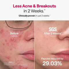 Masque Ulike Lumière Rouge Visage, Couverture 360° Complète
