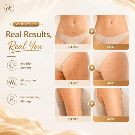 Appareil 3-en-1 Sculptant Corps Anti-Cellulite Massageur Blanc