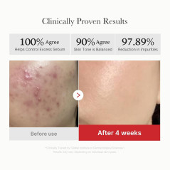 Medicube Toner Pads Peeling Visage Acide Succinique Rouge