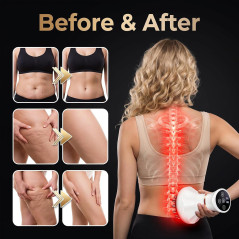 Appareil Drainage Lymphatique & Anti-Cellulite Microcourant